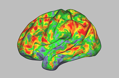 Image showing brain activity during a dose of psilocybin. Image showing brain activity during a dose of psilocybin.