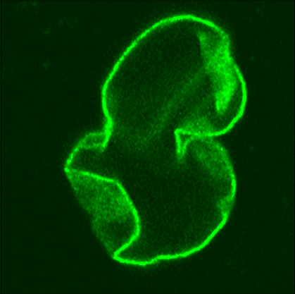 image of a nucleus with structural defects