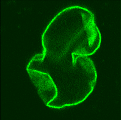 image of a nucleus with structural defects image of a nucleus with structural defects