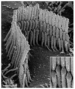 Microscopic structures called stereocilia sit atop a hair cell Microscopic structures called stereocilia sit atop a hair cell