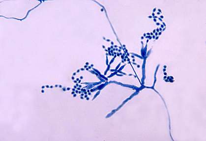 One type of fungus (a Penicillium) under the microscope One type of fungus (a Penicillium) under the microscope