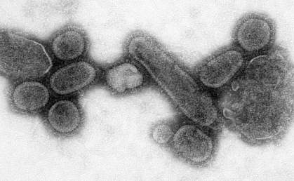 Picture of Influenza viruses from the 1918 Spanish flu epidemic recreated in the laboratory Picture of Influenza viruses from the 1918 Spanish flu epidemic recreated in the laboratory