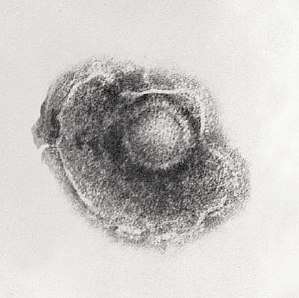 Picture of the varicella-zoster virus close up Picture of the varicella-zoster virus close up