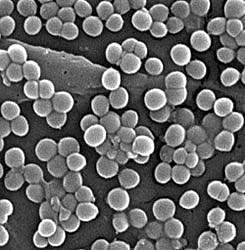 Picture of Staph bacteria magnified 4,780 times Picture of Staph bacteria magnified 4,780 times