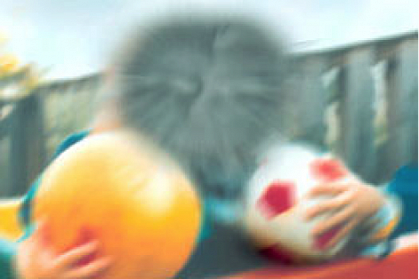 Picture viewed by as it might be viewed by a person with age-related macular degeneration Picture viewed by as it might be viewed by a person with age-related macular degeneration