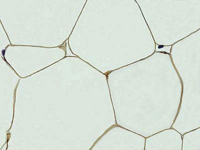Picture of mouse fat cells Picture of mouse fat cells