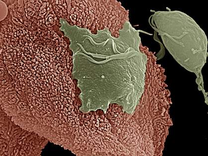 ray parasite attached to vaginal cell on left is flat, while a parasite that's not attached, on right, is pear-shaped ray parasite attached to vaginal cell on left is flat, while a parasite that's not attached, on right, is pear-shaped