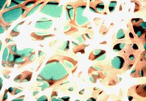 A highly magnified photograph of porous bone matrix A highly magnified photograph of porous bone matrix