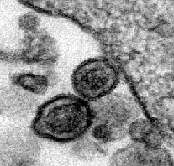 Black and white electron micrograph showing two circular viruses in the center and, to the right, the edge of the larger cell they have just left Black and white electron micrograph showing two circular viruses in the center and, to the right, the edge of the larger cell they have just left