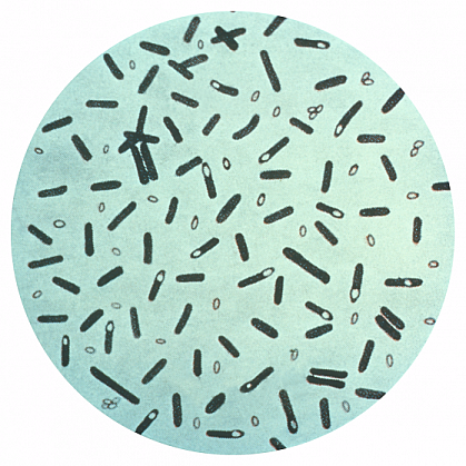 Clostridium botulinum bacteria up close. Clostridium botulinum bacteria up close.