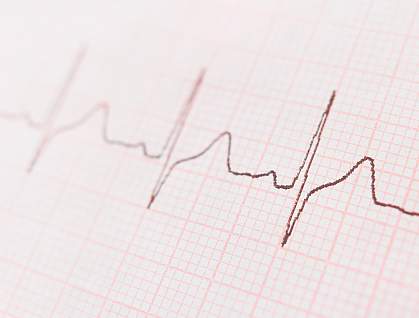 ECG graph showing the heart's rhythm ECG graph showing the heart's rhythm