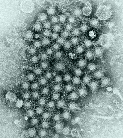 Image with a large cluster of circular viruses Image with a large cluster of circular viruses