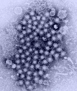 Hepatitis viruses appear as diffuse dark circles clustered together on a light background Hepatitis viruses appear as diffuse dark circles clustered together on a light background