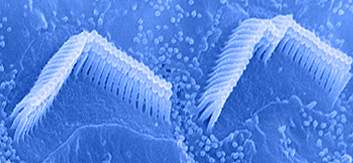 Tubular stereocilia on hair cell surface arranged in three rows of increasing heigh Tubular stereocilia on hair cell surface arranged in three rows of increasing heigh