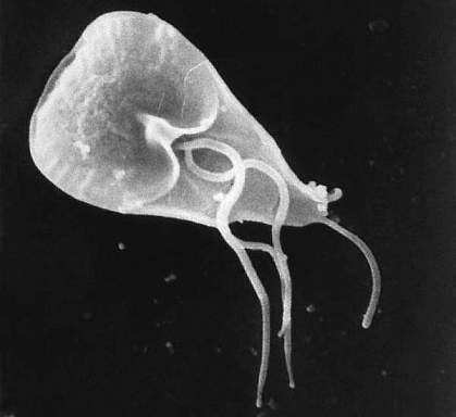 Scanning electron micrograph of microbe shaped like a teardrop with several rope-like flagella