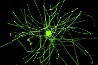 Round cell body with long tendrils reaching in all directions Round cell body with long tendrils reaching in all directions
