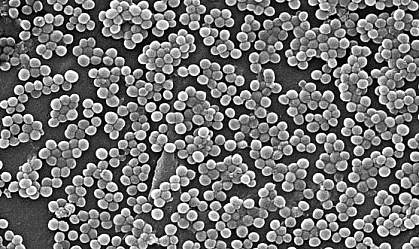 A microscopic photograph of Staphylococcus aureus A microscopic photograph of Staphylococcus aureus