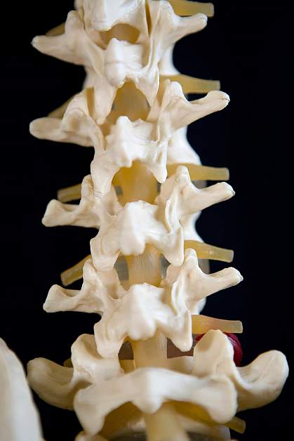 Photo of a model of a spine Photo of a model of a spine