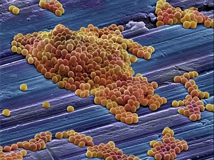 Scanning electron micrograph shows clusters of spherical staph bacteria Scanning electron micrograph shows clusters of spherical staph bacteria