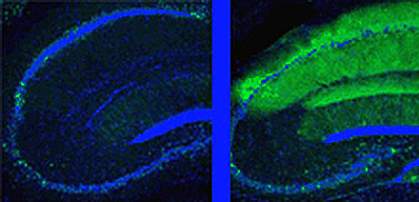 Two panels show the blunt ends of neurons outlined in glowing blue. The left one has very little green and the right one intense green along its upper surface Two panels show the blunt ends of neurons outlined in glowing blue. The left one has very little green and the right one intense green along its upper surface