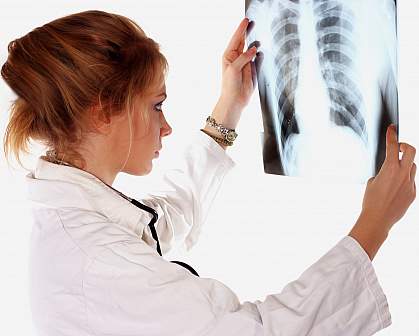 Photo of a female doctor looking at a lung x-ray Photo of a female doctor looking at a lung x-ray