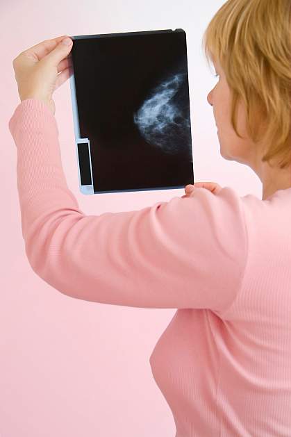 Photo of a woman looking at a mammogram X-ray Photo of a woman looking at a mammogram X-ray