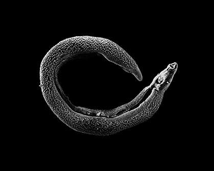 Microscopic worm curled into C shape Microscopic worm curled into C shape