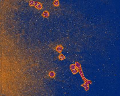 Electron micrograph of Influenza A Electron micrograph of Influenza A