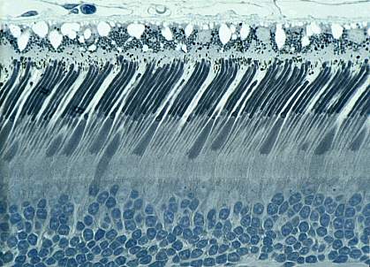 Rod and cone cells.