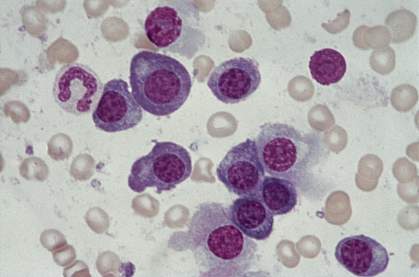 Microscope image of several globular cells stained purple Microscope image of several globular cells stained purple