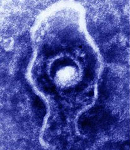 Microscopic image of the herpes virus Microscopic image of the herpes virus