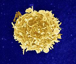 Scanning electron micrograph of a T Cell Scanning electron micrograph of a T Cell