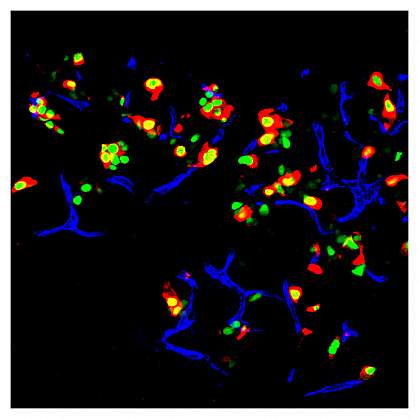 Microscope image of multicolored cells in a mouse pancreas Microscope image of multicolored cells in a mouse pancreas