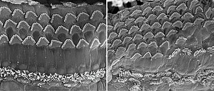Two panels of cells with V-shaped clusters of microscopic hair-like structures on their surfaces. The right panel shows more hair cells crowded together Two panels of cells with V-shaped clusters of microscopic hair-like structures on their surfaces. The right panel shows more hair cells crowded together