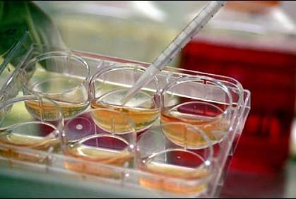 Photo of cultured stem cells in a well plate Photo of cultured stem cells in a well plate