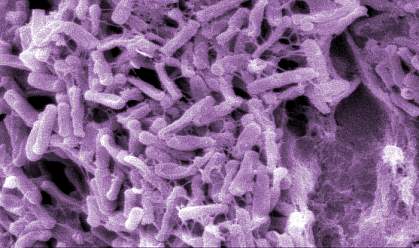 Electron micrograph showing cluster of many bacteria Electron micrograph showing cluster of many bacteria