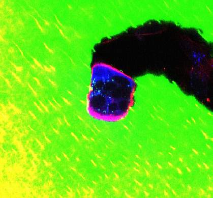 Photo of a microscope image of cell tunneling through bone matrix, leaving a black trail Photo of a microscope image of cell tunneling through bone matrix, leaving a black trail