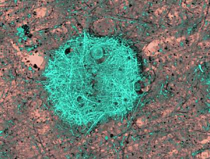 Image of a blue-green fibrous mass Image of a blue-green fibrous mass