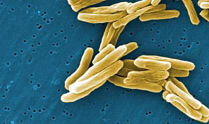 Electron micrograph of several rod-shaped bacteria