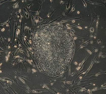 Cluster of long, thin cells around a central mass Cluster of long, thin cells around a central mass
