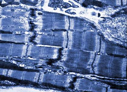 Image of a cardiac muscle cell Image of a cardiac muscle cell