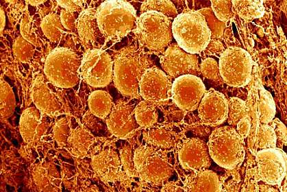 Globular fat cells Globular fat cells