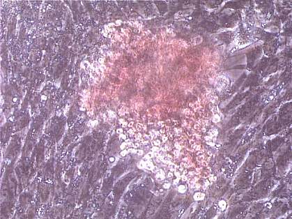 Image of a colony of red blood cells Image of a colony of red blood cells