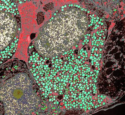 Electron micrograph of a cell packed with round granules