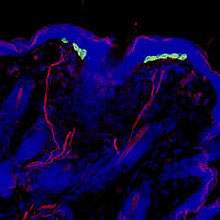 Image of skin tissue shows clusters of green cells linked to red nerve fibers