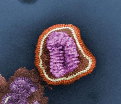 Electron micrograph image of an influenza virus Electron micrograph image of an influenza virus