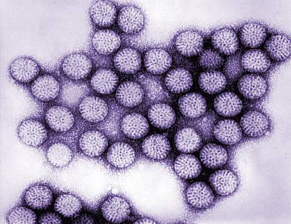 Cluster of round rotavirus particles Cluster of round rotavirus particles