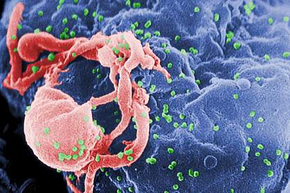 HIV viruses bud from an immune cell HIV viruses bud from an immune cell