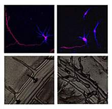 Image panel shows that atlastin/RHD3 deficiency causes shortening of rat neurons and short, wavy root hairs in a plant Image panel shows that atlastin/RHD3 deficiency causes shortening of rat neurons and short, wavy root hairs in a plant