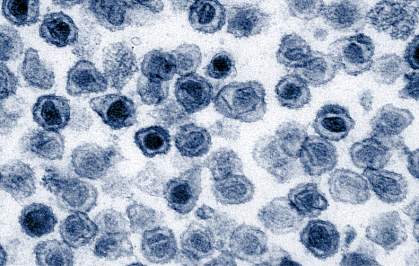 Transmission electron micrograph of round virus particles